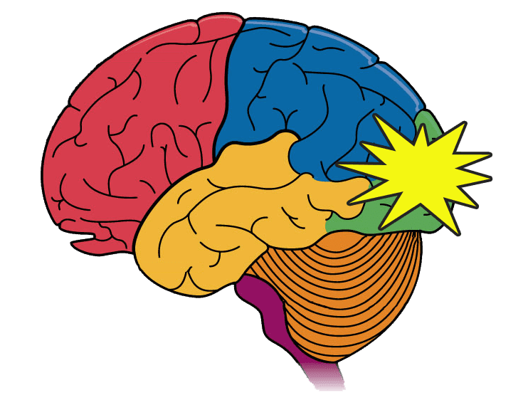 occipital-lobe-seizure - EWCT