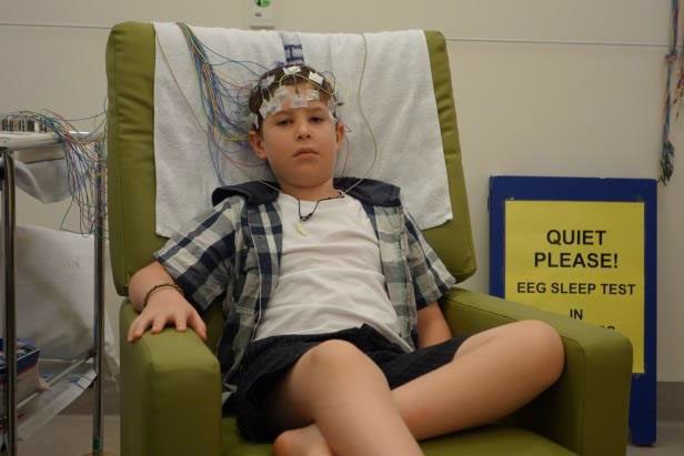 absence-seizure-eeg