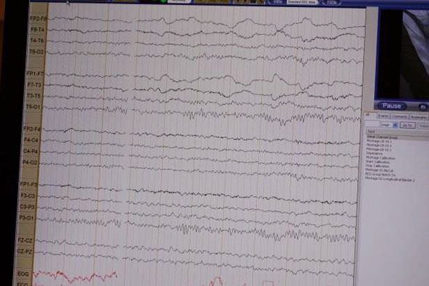 eeg-brainwaves-chart